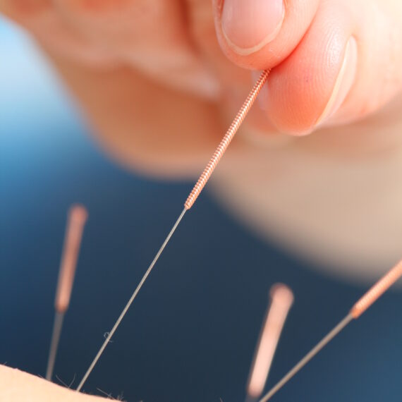close up of hand performing acupuncture